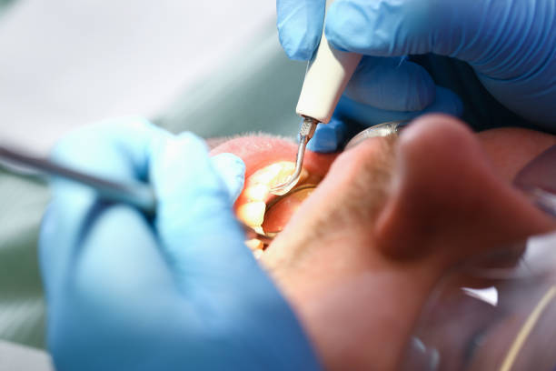 Best Emergency Pediatric Dental Care in Bloomfield Hills, MI